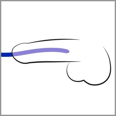 Silicone Dilator Set ORION
