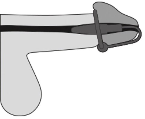 Penis Plug+Silicone Glans Ring ORION